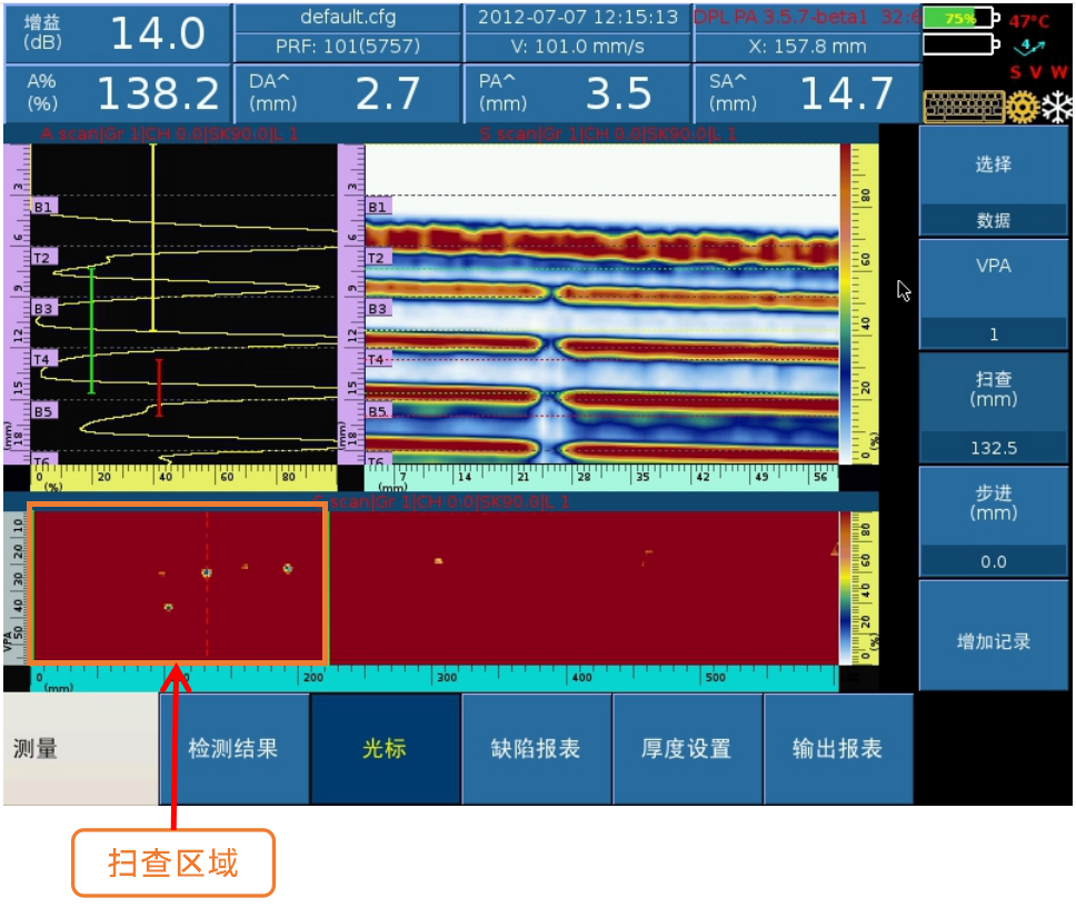 扫查2图.png